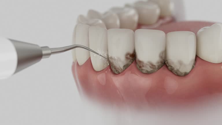 Trusted Emergency Dentist service in Keokuk, IA - Dentist Open Now